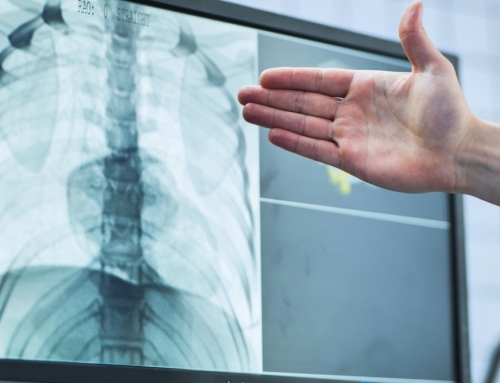 Do Misread X-Rays or Lab Results Count as Medical Malpractice in Florida?